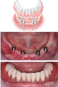 Dental Services in Tardeo