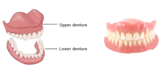 Dentures & Dental Services in Mumbai