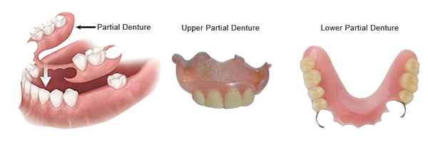 Dental Services in Mumbai