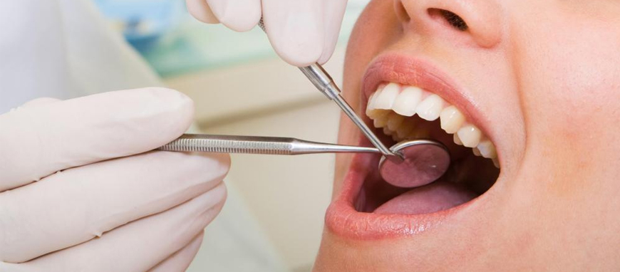 Full Mouth Rehabilitation in India