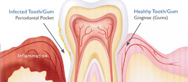 pediatric dentist service in Mumbai pediatric dentist service in Mumbai