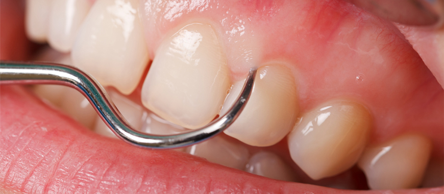 pediatric dentist service in mumbai pediatric dentist service in mumbai