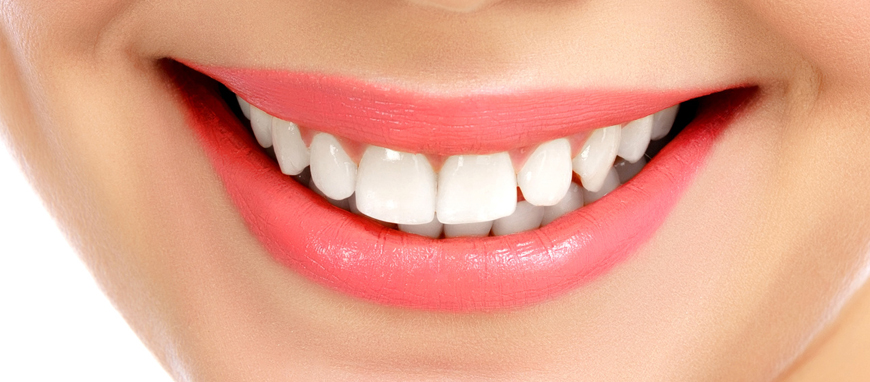 Smile Designing Teeth Shape in Mumbai